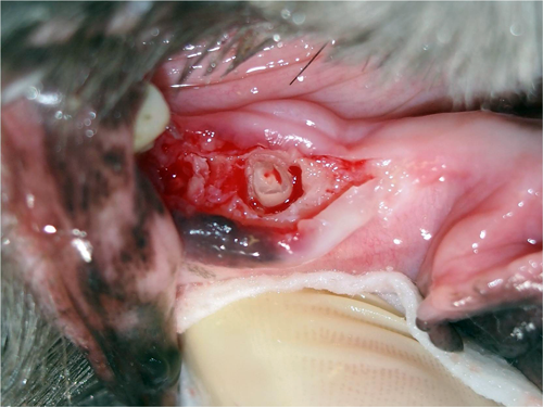 Extraction d'un fragment de dent