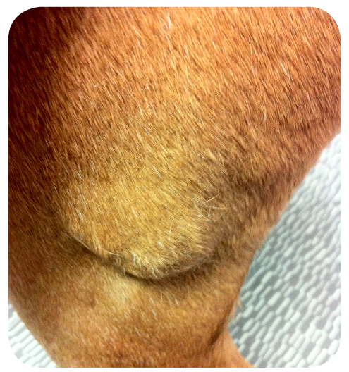 Focus DMV Oncologie Sarcome des tissus mous du membre pelvien gauche